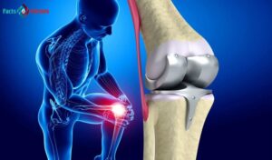 Orthopedic Biomaterials Market